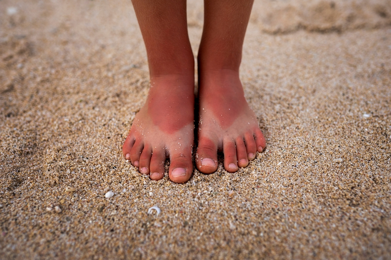 sunburned feet standing on sand